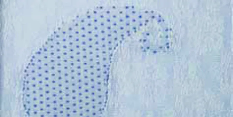 221.218